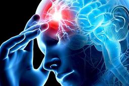 Геморрагический инсульт: причины, симптомы и лечение.